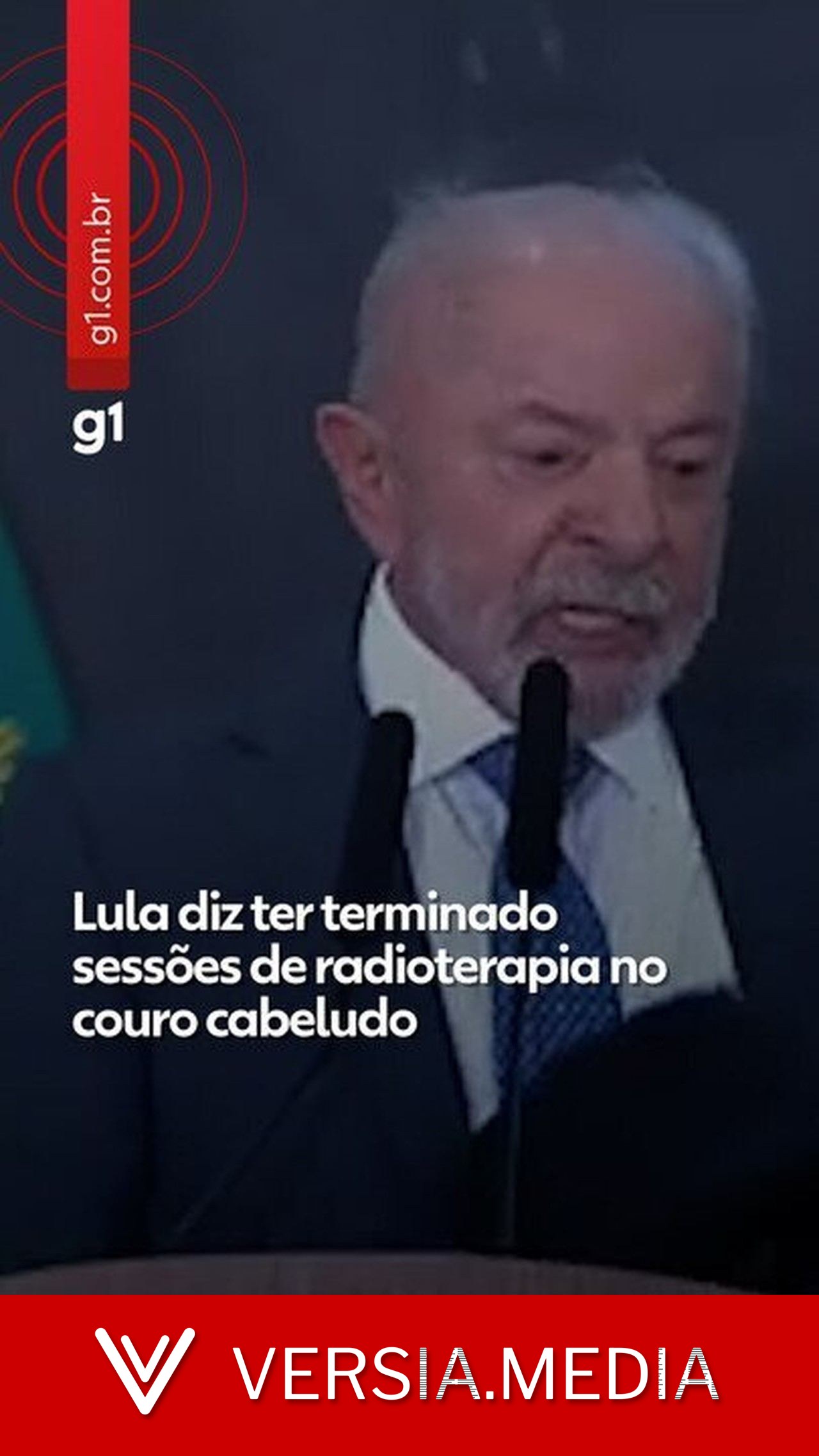 Lula diz ter terminado sessões de radioterapia no couro cabeludo: 'Feliz pela cura definitiva' — Politics | Versia.media